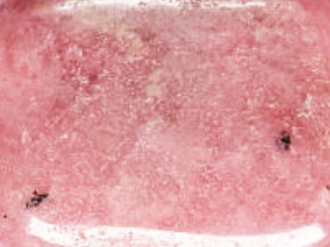 Rhodochrosite